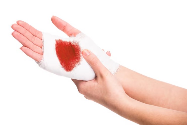 Mơ đánh nhau chảy máu nhưng không đau